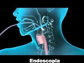 Video Endoscopia Digestiva Alta